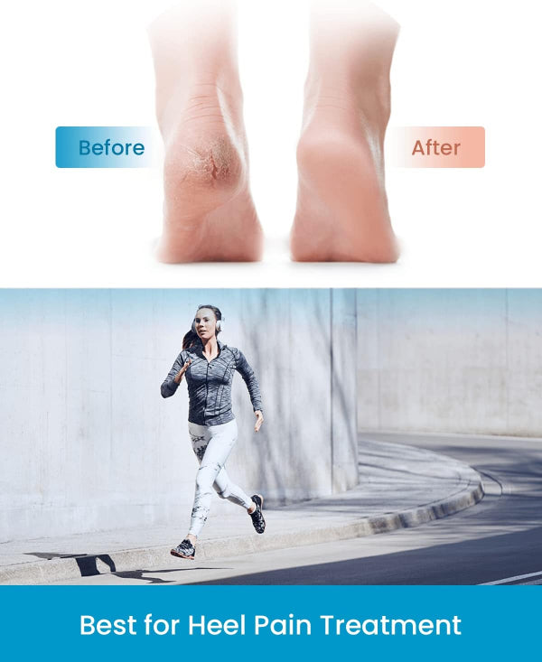 heel cups for heel pain, plantar fasciitis heel support, silicone heel protectors, heel cushions for bone spur, shock absorbing heel pads, orthopedic heel support, heel spur inserts, foot pain relief.