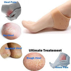 Anti heel crack socks pain foot gel relief silicone moisturizing support dry hard swelling care pair ankle protector - AABA MALL